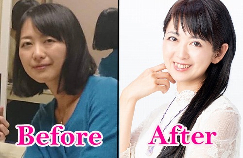 Before&After